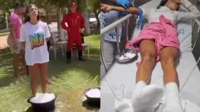 MC Thammy sofreu queimadura nos pés durante prova de reality show de Anderson Neiff — Foto: Reprodução/Instagram