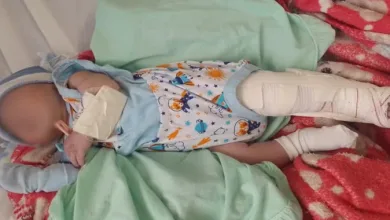 Criança passa bem, apesar da perna quebrada em maternidade da RMS — Foto: Reprodução/ Redes sociais
